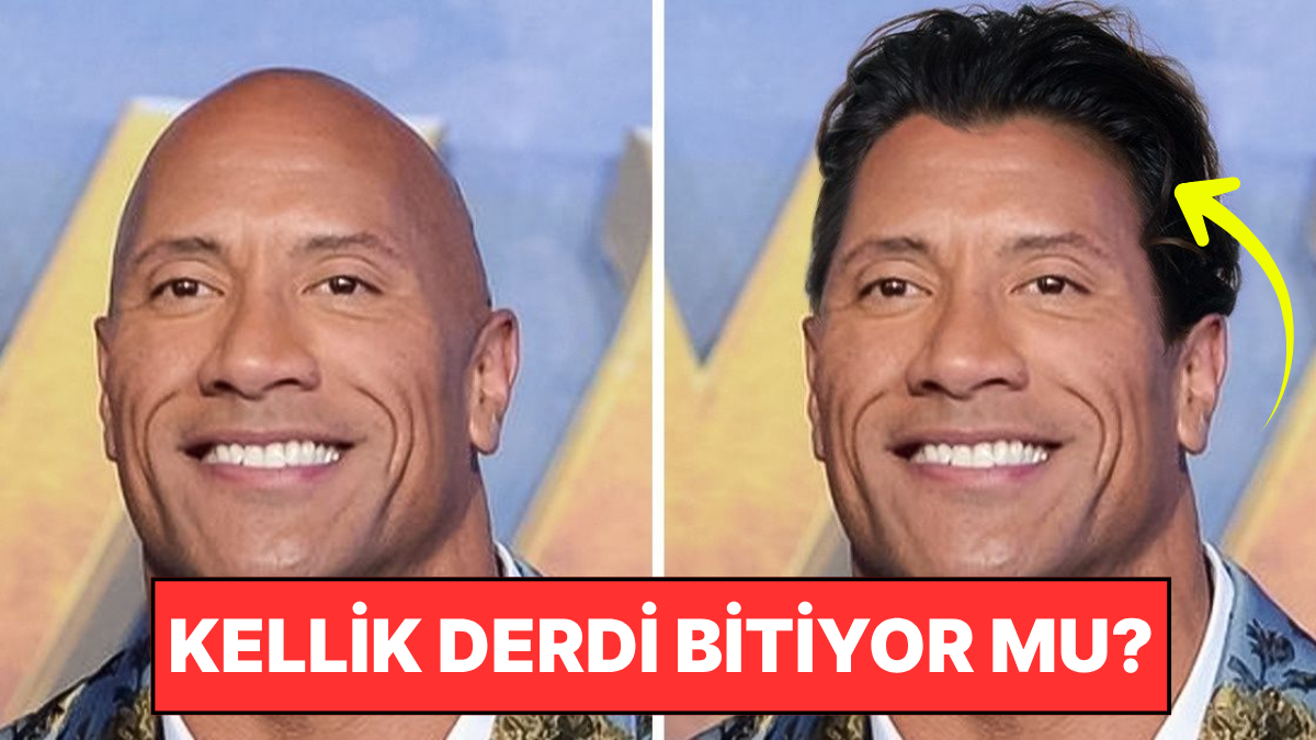 kellik tarihe mi karisiyor bilim insanlari sacin yeniden uzamasini saglayan serum kesfetti GdhjwrC2.jpg